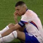 Mbappe le nez casse1